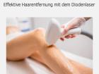 Ice Diodenlaser haarentfernung Körperpflege für Frauen und Männer